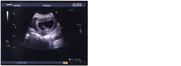 怀孕,宝宝,准爸爸