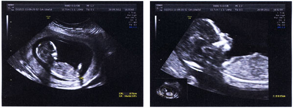 怀孕,宝宝,准爸爸